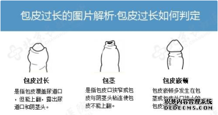 上饶库车县哪家医院有治疗包皮手术