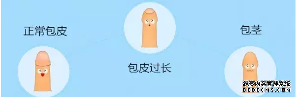 上饶拜城县有什么YAO物治疗包皮